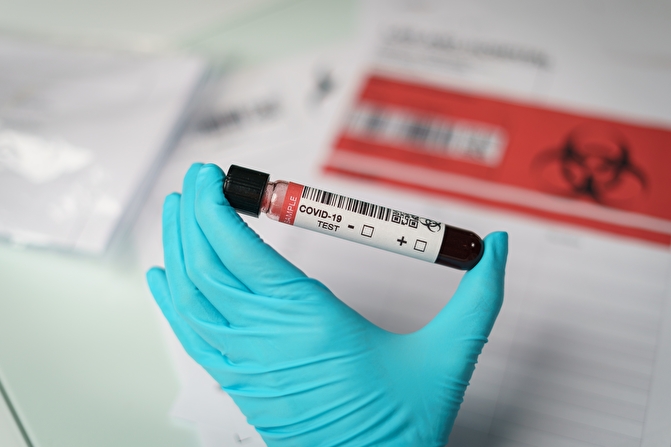 Coronavirus-Tests,eine Hand hält Tube von Blut-Testproben von