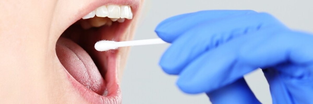 Nahaufnahme. Eine Hand in einem blauen Latexhandschuh nimmt einen Rachenabstrich bei einer Person mit geöffnetem Mund.